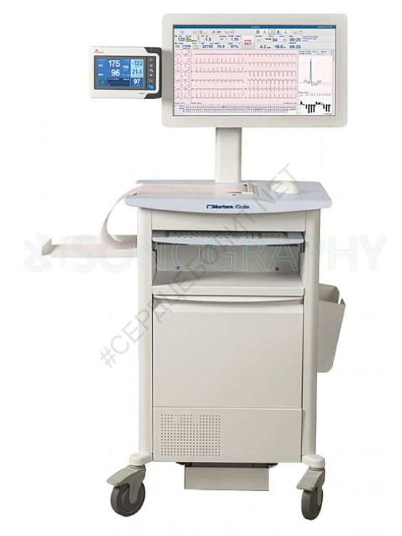 Screenshot_20241130_170726 Стресс-тест система X-Scribe с опцией DICOM Mortara — изображение 1